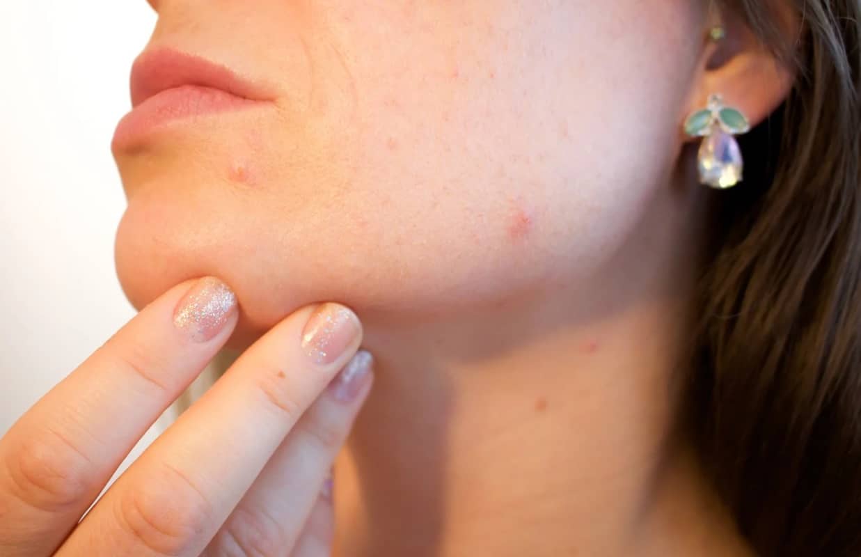 sensitive skin